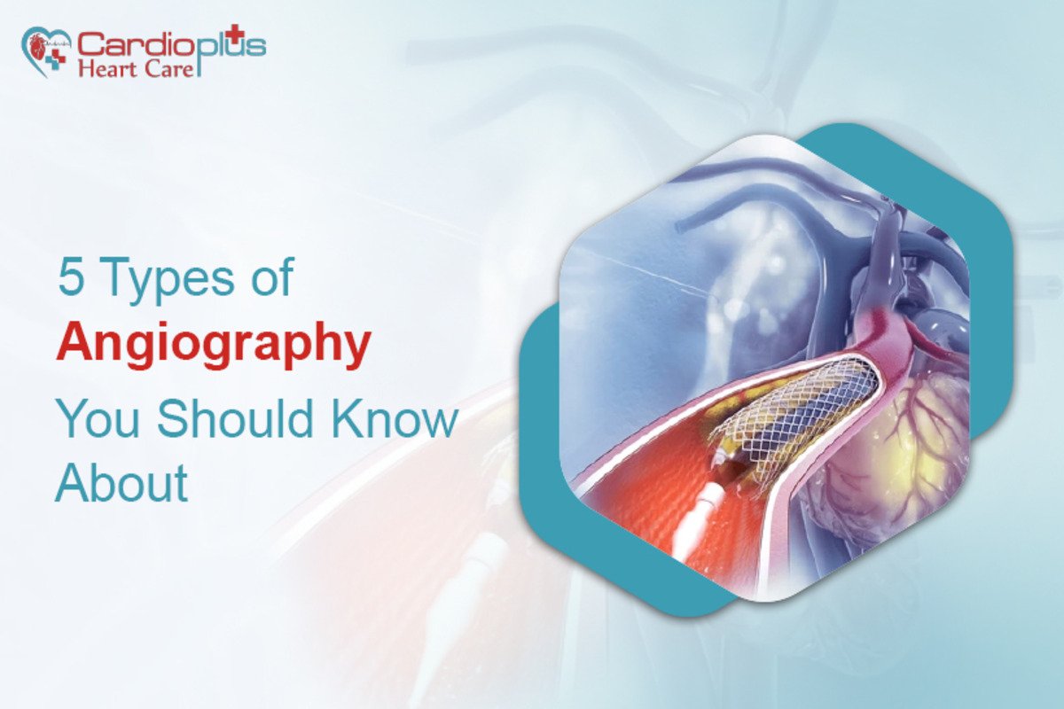 5 types of angiography you should know about