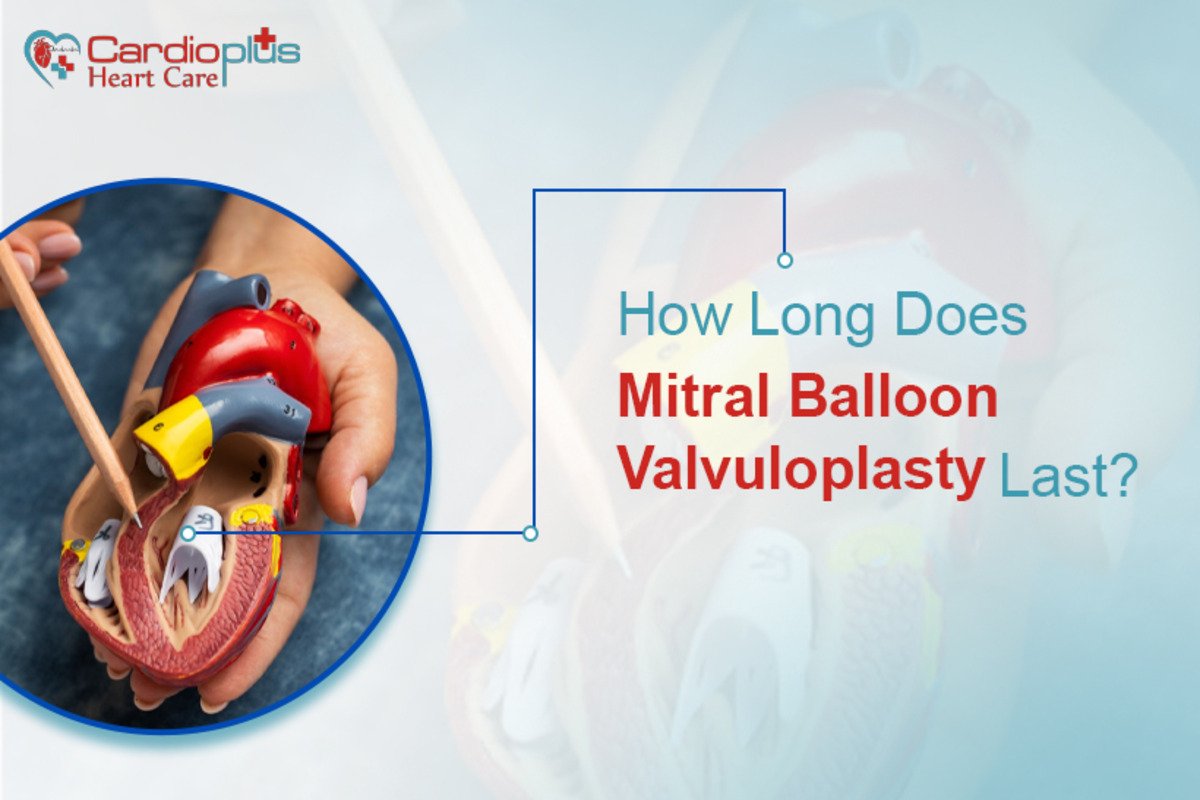 how long does mitral balloon valvuloplasty last