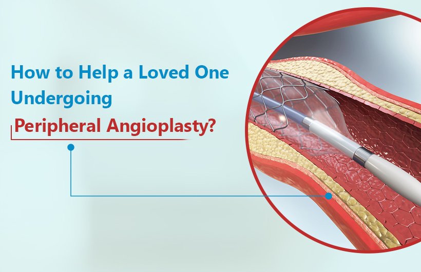 how to help a loved one undergoing peripheral angioplasty