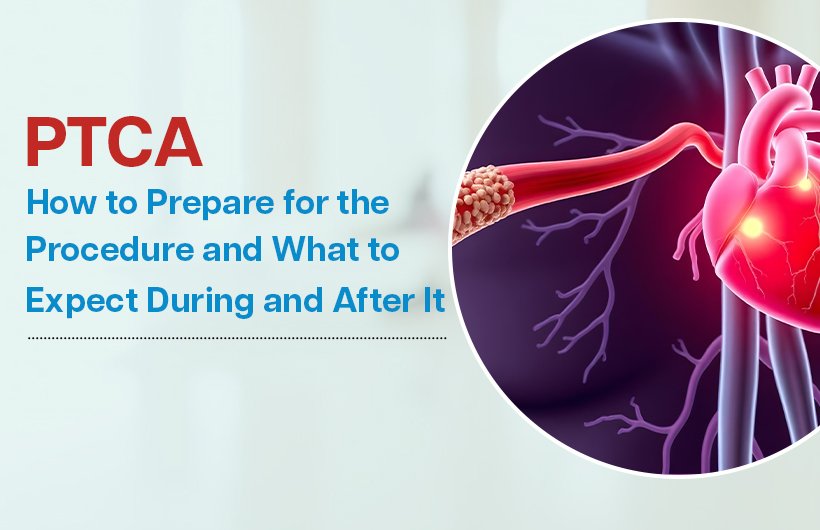 how to prepare for the procedure and what to expect during ptca