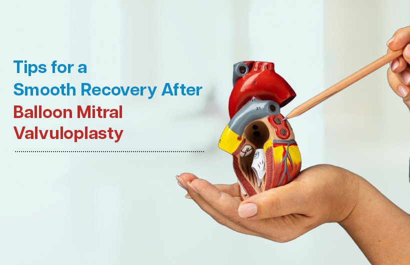 tips for a smooth recovery after balloon mitral valvuloplasty
