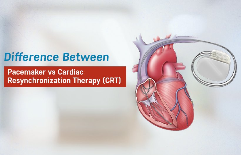 pacemaker vs crt