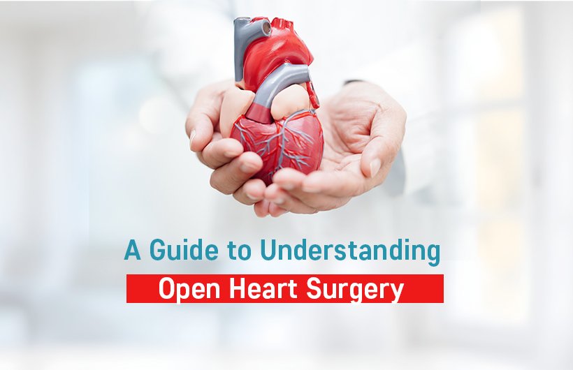 A Guide to Understanding Open Heart Surgery