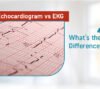 echocardiogram vs ekg