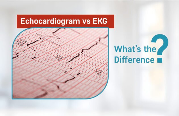 echocardiogram vs ekg