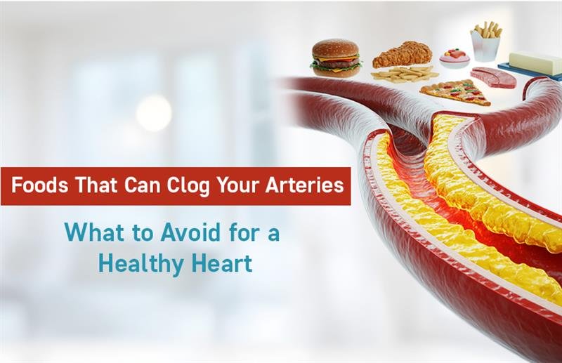 artery-clogging foods