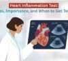 heart inflammation test