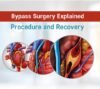 heart bypass surgery