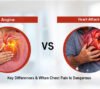 angina vs heart attack