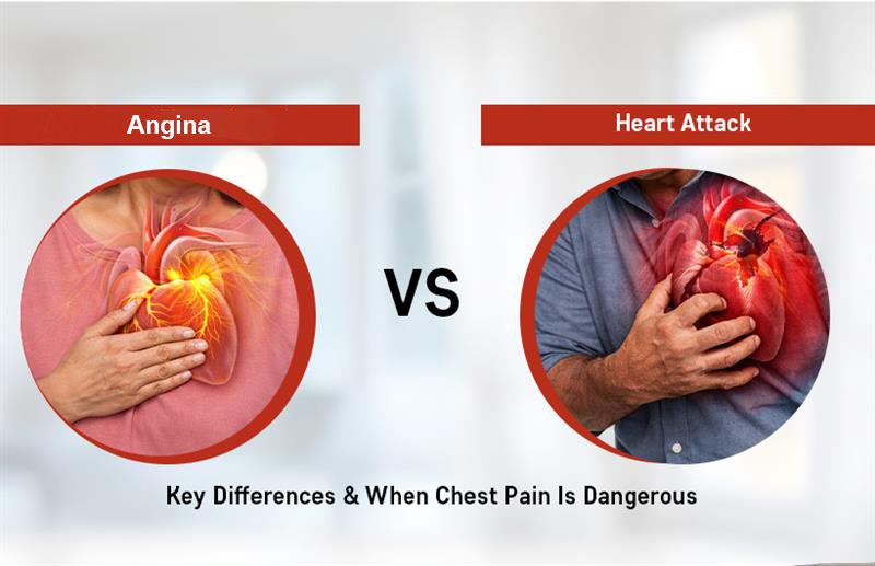 angina vs heart attack