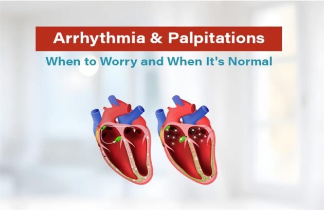 arrhythmia & palpitations