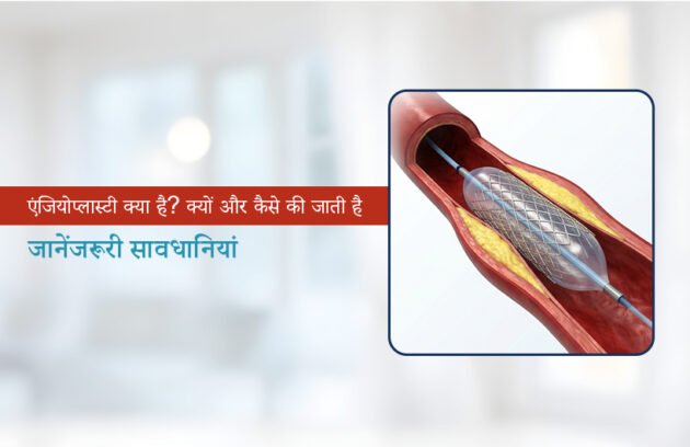 Angioplasty in Hindi
