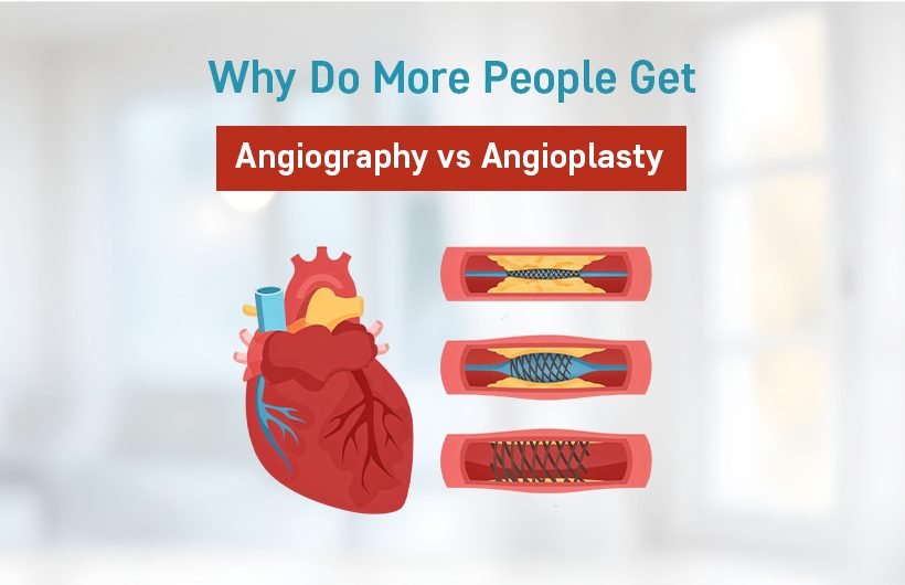 angiography vs angioplasty