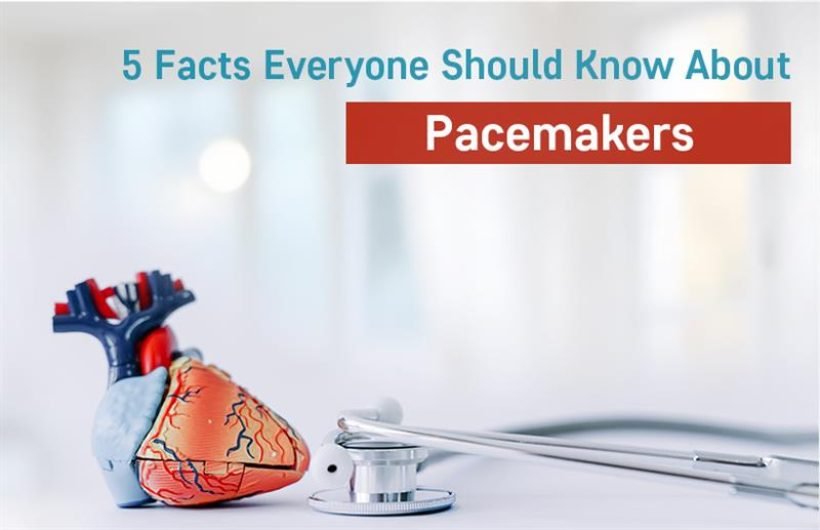 pacemaker implantation